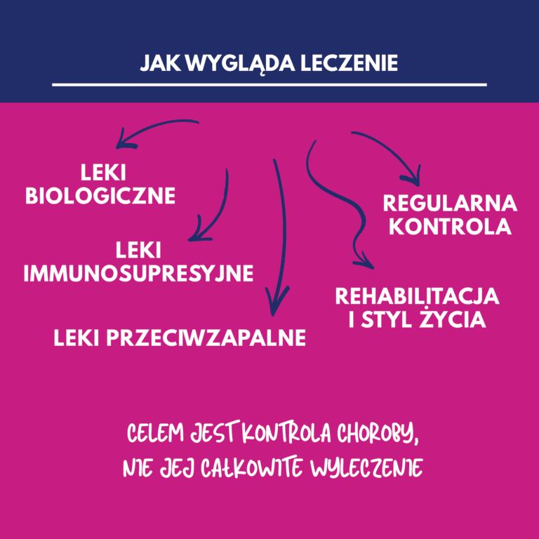 Jak wygląda leczenie chorób autoimmunologicznych - infografika 