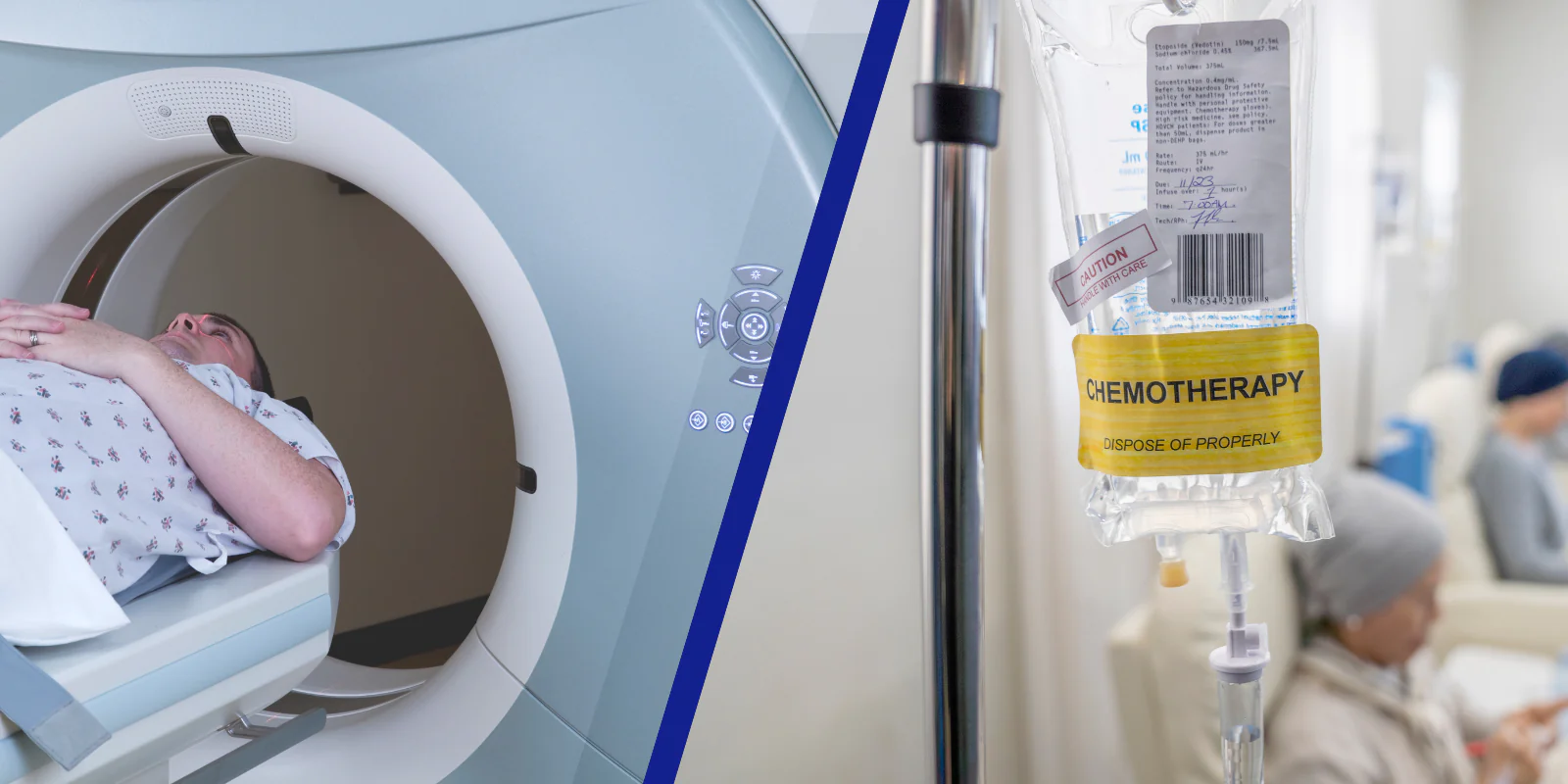 Radioterapia a&nbsp;chemioterapia – przewodnik